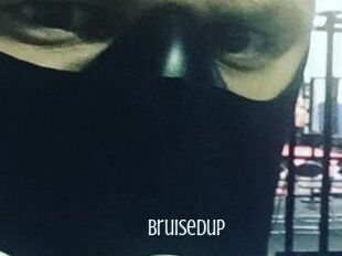 Bruisedup
